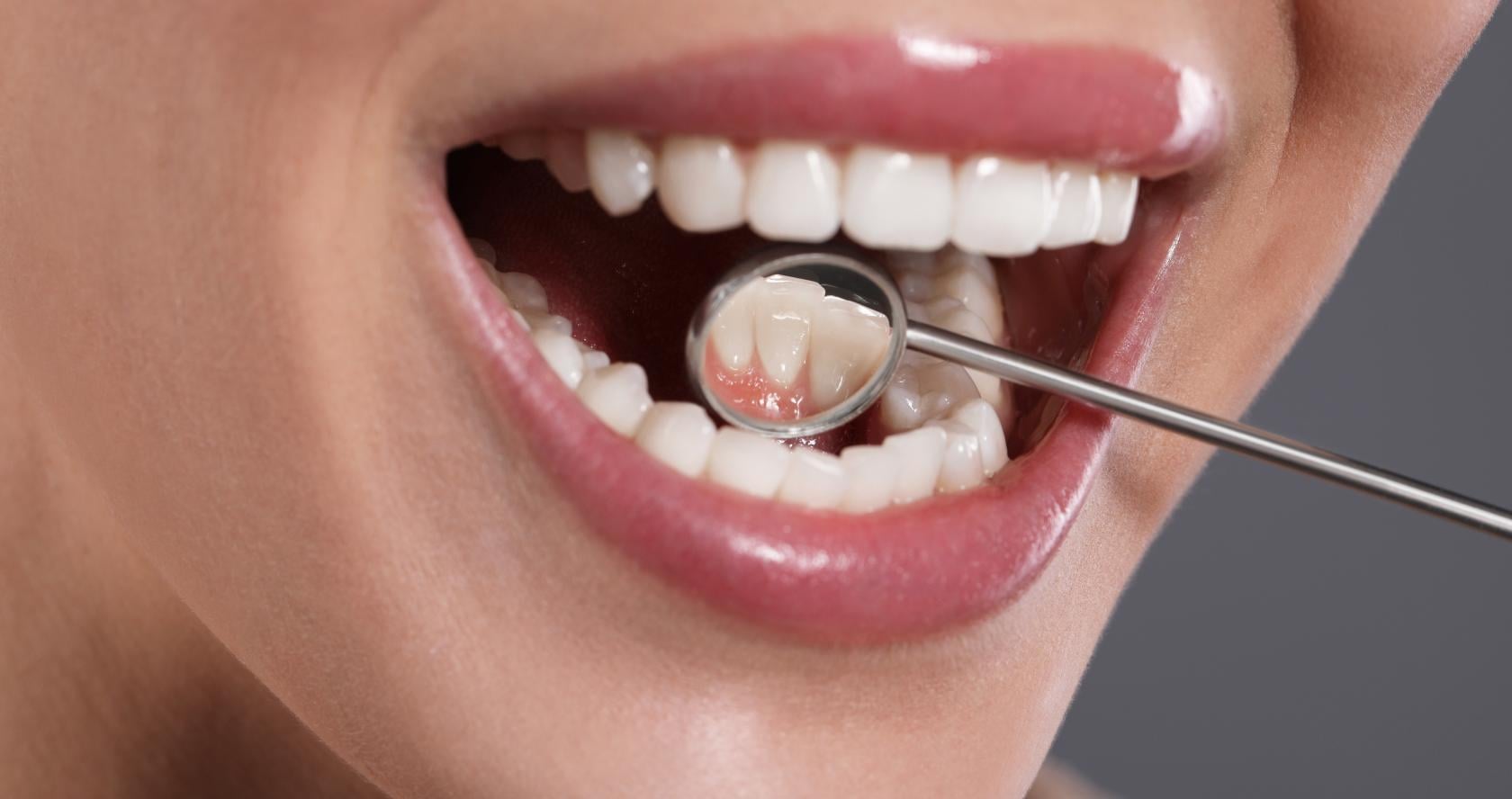 Salud bucodental