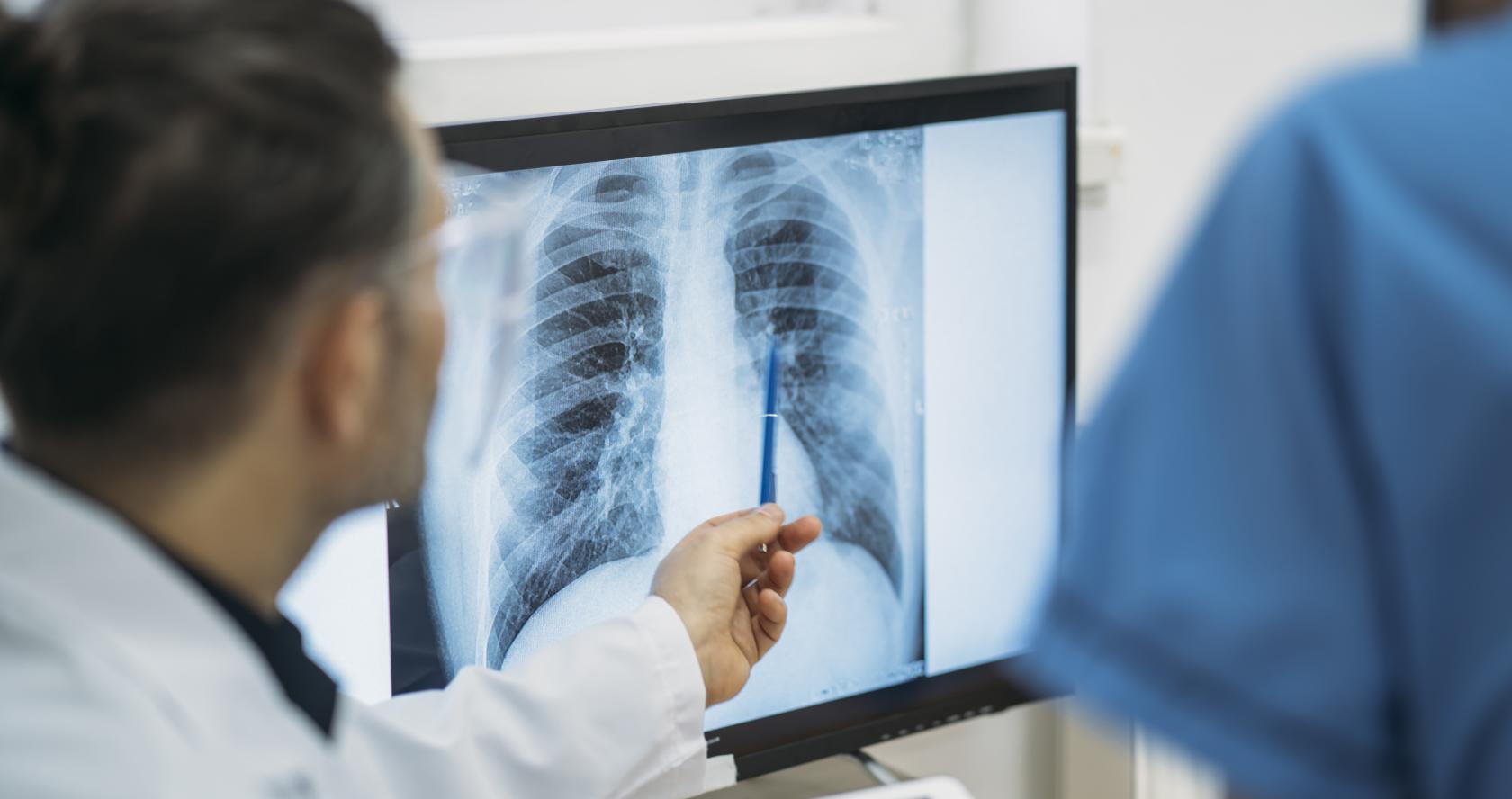 Medico señalando una radiografia junto a un paciente