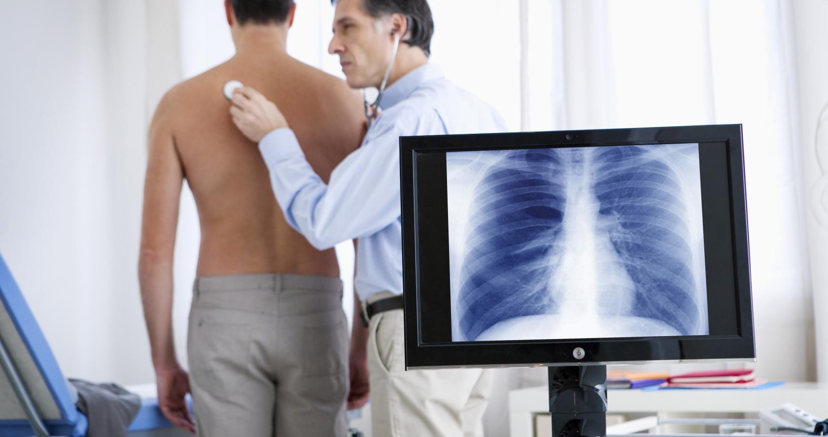 Medico oscultando a un paciente detras de un ordenador con la imagen de un pulmón