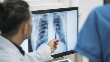 Medico señalando una radiografia junto a un paciente