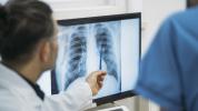 Medico señalando una radiografia junto a un paciente