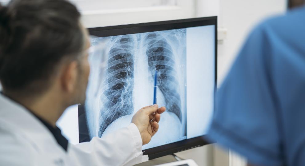 Medico señalando una radiografia junto a un paciente